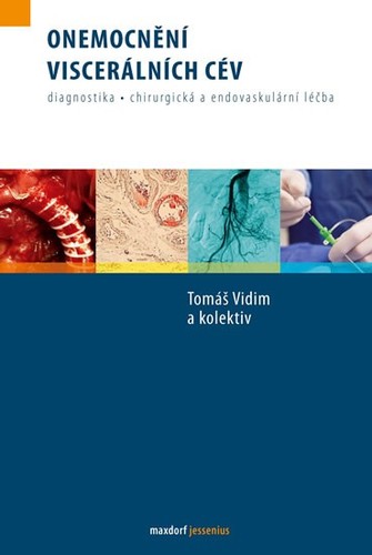 Onemocnění viscerálních cév - Kolektív autorov,Tomáš Vidim