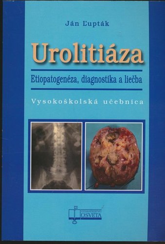 Urolitiáza - Ján Ľupták