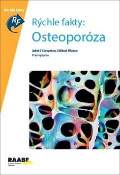 Rýchle fakty: Osteoporóza - Kolektív autorov