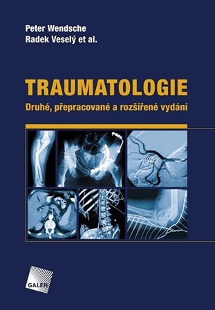 Traumatologie (Druhé, přepracované a rozšířené vydání) - Kolektív autorov,Radek Veselý,Peter Wendsche