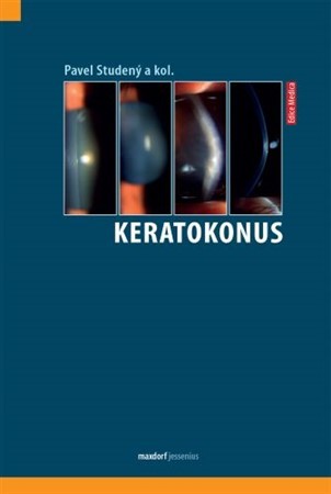 Keratokonus - Pavel Studený,Kolektív autorov