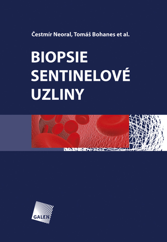 Biopsie sentinelové uzliny - Čestmír Neoral,Tomáš Bohanes a kolektív