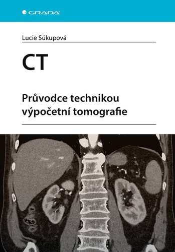 CT - Průvodce technikou výpočetní tomografie - Lucie Súkupová
