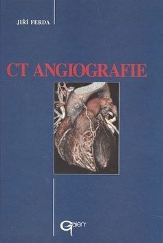 CT Angiografie