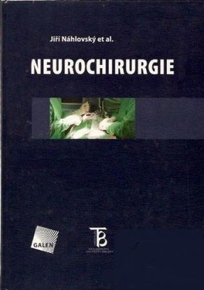 Neurochirurgie