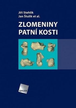 Zlomeniny patní kosti