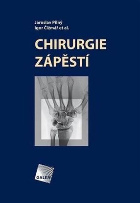 Chirurgie zápěstí