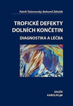 Trofické defekty dolních končetin