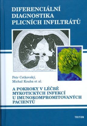 Diferenciální diagnostika plicních infiltrátů