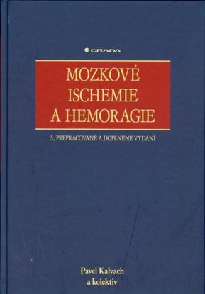 Mozkové ischemie a hemoragie