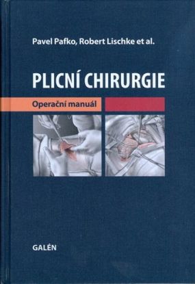 Plicní chirurgie