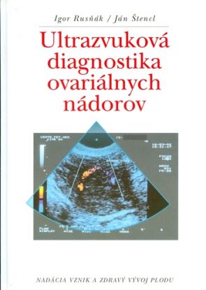 Ultrazvuková diagnostika ovariálnych nádorov