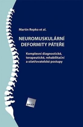 Neuromuskulárni deformity páteře