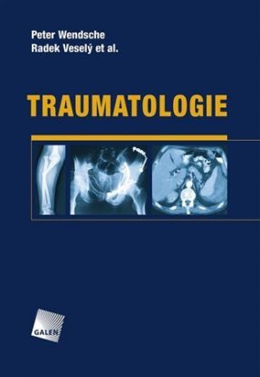 Traumatologie