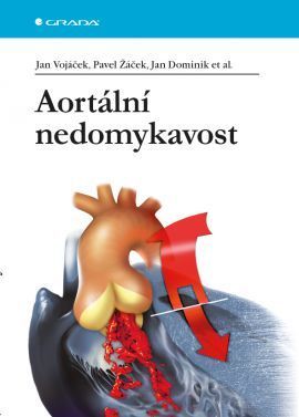 Aortální nedomykavost