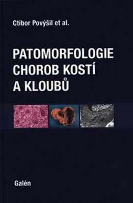 Patomorfologie chorob kostí a kloubů