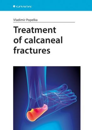 Treatment of Calcaneal Fractures