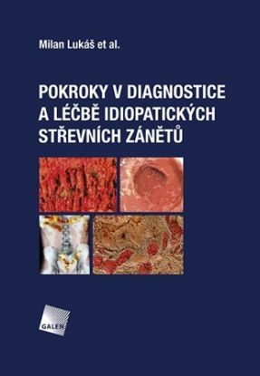 Pokroky v diagnostice a léčbě idiopatických střevních zánětů