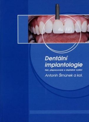 Dentální implantologie