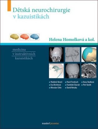 Dětská neurochirurgie v kazuistikách