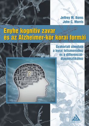 Enyhe kognitív zavar és az Alzheimer-kór korai formái