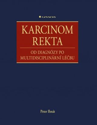 Karcinom rekta