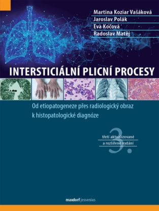 Intersticiální plicní procesy, 3. vydání